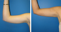 Before & After Photos